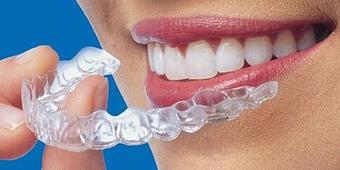 Product - Newton Dentistry in Auburndale - Newton, MA Dental Bonding & Cosmetic Dentistry