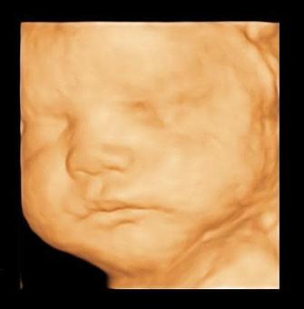 Product - Pure View 3D Ultrasound Studio in San Diego, CA Health & Medical