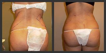 Product - Reneu Health & Medispa - Jill Wohlfeil in Oconomowoc, WI Health & Medical