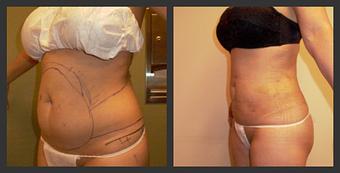 Product - Reneu Health & Medispa - Jill Wohlfeil in Oconomowoc, WI Health & Medical