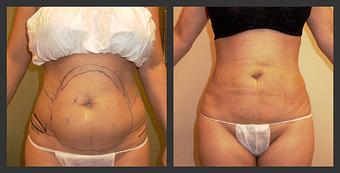 Product - Reneu Health & Medispa - Jill Wohlfeil in Oconomowoc, WI Health & Medical