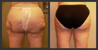 Product - Reneu Health & Medispa - Jill Wohlfeil in Oconomowoc, WI Health & Medical