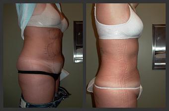 Product - Reneu Health & Medispa - Jill Wohlfeil in Oconomowoc, WI Health & Medical
