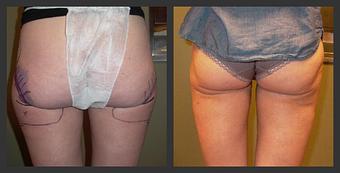 Product - Reneu Health & Medispa - Jill Wohlfeil in Oconomowoc, WI Health & Medical