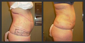 Product - Reneu Health & Medispa - Jill Wohlfeil in Oconomowoc, WI Health & Medical