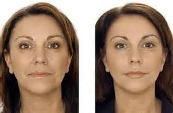 Product - Reneu Health & Medispa - Jill Wohlfeil in Oconomowoc, WI Health & Medical