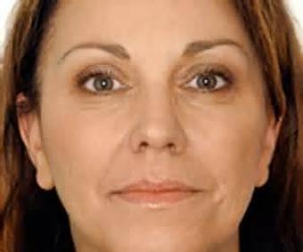 Product - Reneu Health & Medispa - Jill Wohlfeil in Oconomowoc, WI Health & Medical