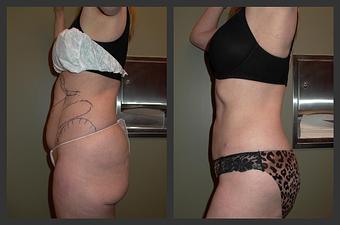 Product - Reneu Health & Medispa - Jill Wohlfeil in Oconomowoc, WI Health & Medical