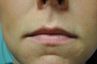 Product - Roseville Facial Plastic Surgery in Roseville, CA Physicians & Surgeons Plastic Surgery