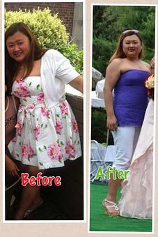 Product - Safe Laser Therapy in Stamford, CT Day Spas