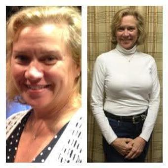 Product - Safe Laser Therapy in Stamford, CT Day Spas