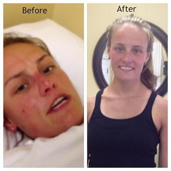 Product - Safe Laser Therapy in Stamford, CT Day Spas