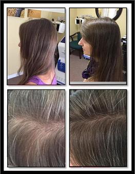 Product - Safe Laser Therapy in Stamford, CT Day Spas