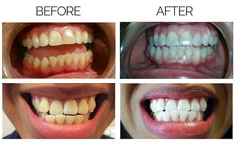 Product - Skin Laser in McAllen, TX Skin Care Products & Treatments