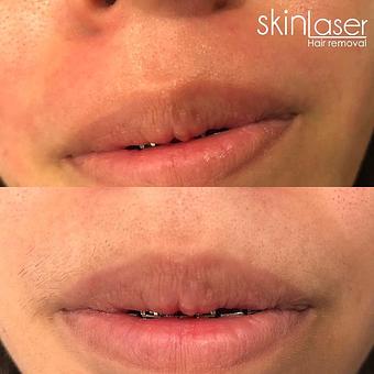 Product - Skin Laser in McAllen, TX Skin Care Products & Treatments