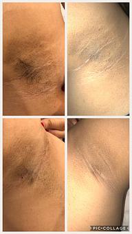 Product - Skin Laser in McAllen, TX Skin Care Products & Treatments