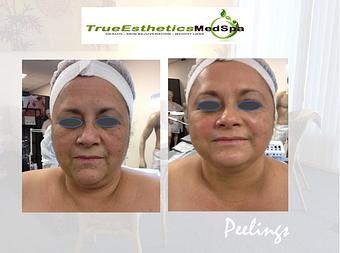 Product - True Esthetics Services in Miramar, FL Beauty Salons