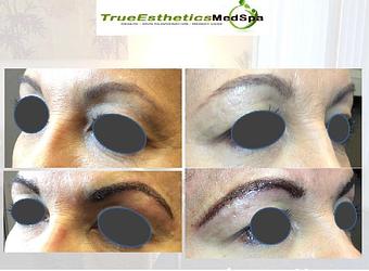 Product - True Esthetics Services in Miramar, FL Beauty Salons