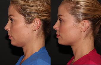 Product - Zen Aesthetics and Wellness in Sycamore Square - Edmond, OK Day Spas