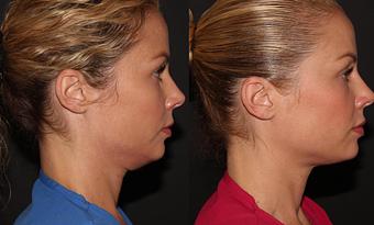 Product - Zen Aesthetics and Wellness in Sycamore Square - Edmond, OK Day Spas