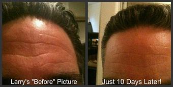Product: It works on everyone, even men! - A Total Image Solution in Spanaway, WA Day Spas