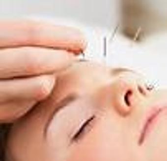 Product: Acupuncture - painless relief - Alternative Therapy in Braden Woods - Bradenton, FL Alternative Medicine