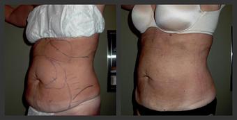 Product - Reneu Health & Medispa - Jill Wohlfeil in Oconomowoc, WI Health & Medical