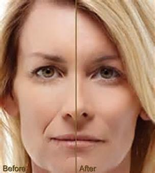 Product - Reneu Health & Medispa - Jill Wohlfeil in Oconomowoc, WI Health & Medical