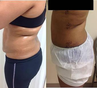 Product - True Esthetics Services in Miramar, FL Beauty Salons