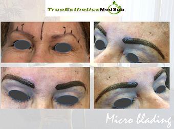 Product - True Esthetics Services in Miramar, FL Beauty Salons
