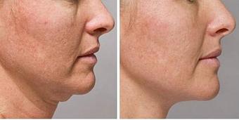 Product - True Esthetics Services in Miramar, FL Beauty Salons