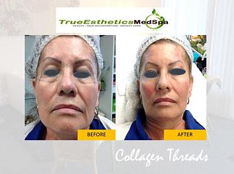 Product - True Esthetics Services in Miramar, FL Beauty Salons
