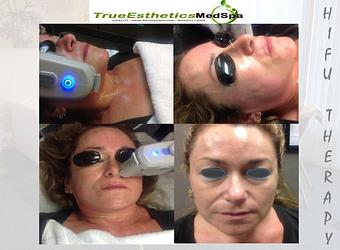 Product - True Esthetics Services in Miramar, FL Beauty Salons