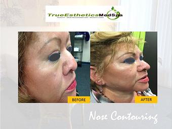 Product - True Esthetics Services in Miramar, FL Beauty Salons