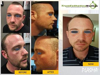 Product - True Esthetics Services in Miramar, FL Beauty Salons