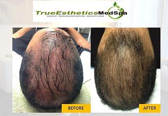 Product - True Esthetics Services in Miramar, FL Beauty Salons