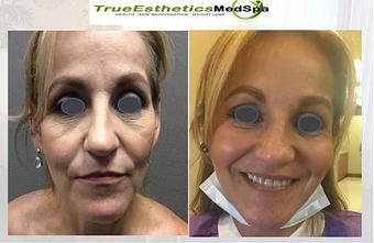 Product - True Esthetics Services in Miramar, FL Beauty Salons