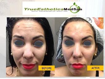 Product - True Esthetics Services in Miramar, FL Beauty Salons