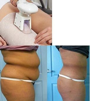 Product - True Esthetics Services in Miramar, FL Beauty Salons