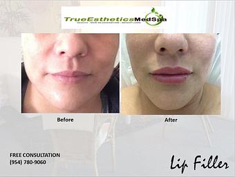 Product - True Esthetics Services in Miramar, FL Beauty Salons