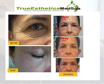 Product - True Esthetics Services in Miramar, FL Beauty Salons