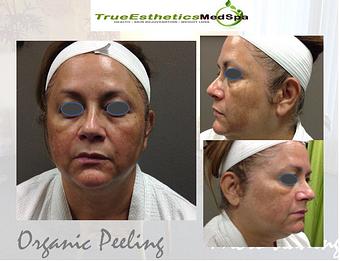 Product - True Esthetics Services in Miramar, FL Beauty Salons