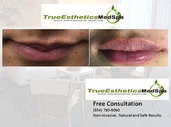 Product - True Esthetics Services in Miramar, FL Beauty Salons