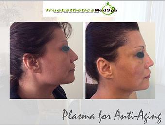 Product - True Esthetics Services in Miramar, FL Beauty Salons