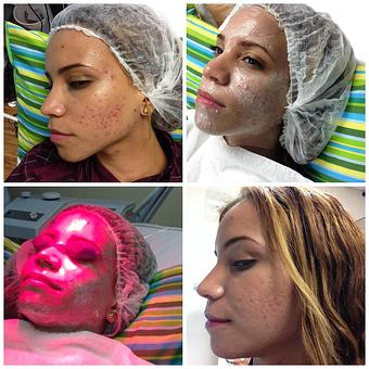 Product - True Esthetics Services in Miramar, FL Beauty Salons