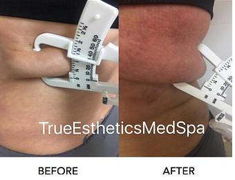 Product - True Esthetics Services in Miramar, FL Beauty Salons