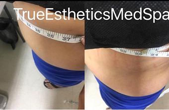 Product - True Esthetics Services in Miramar, FL Beauty Salons