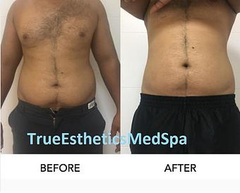 Product - True Esthetics Services in Miramar, FL Beauty Salons