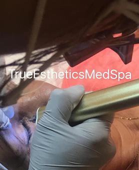 Product - True Esthetics Services in Miramar, FL Beauty Salons
