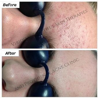 Product: Skin Revision - Viriditas Beautiful Skin Therapies in Historic East Side of Providence - Providence, RI Skin Care Products & Treatments